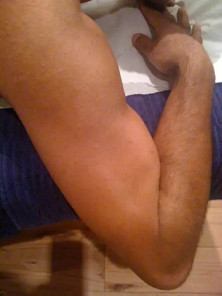 After: Swipe To View More Images