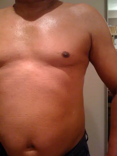 After: Swipe To View More Images