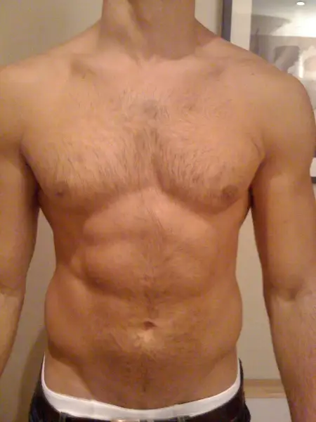 Before: Swipe To View More Images