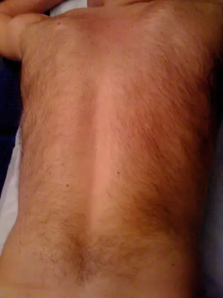 Before: Swipe To View More Images