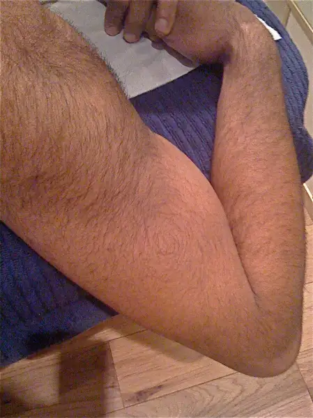 Before: Swipe To View More Images