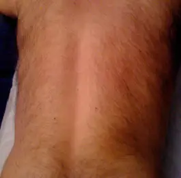 Before: Click Here To View Larger Image