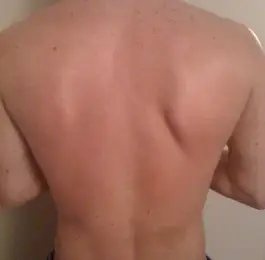 After: Click Here To View Larger Image