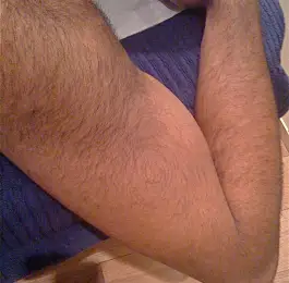 Before: Click Here To View Larger Image